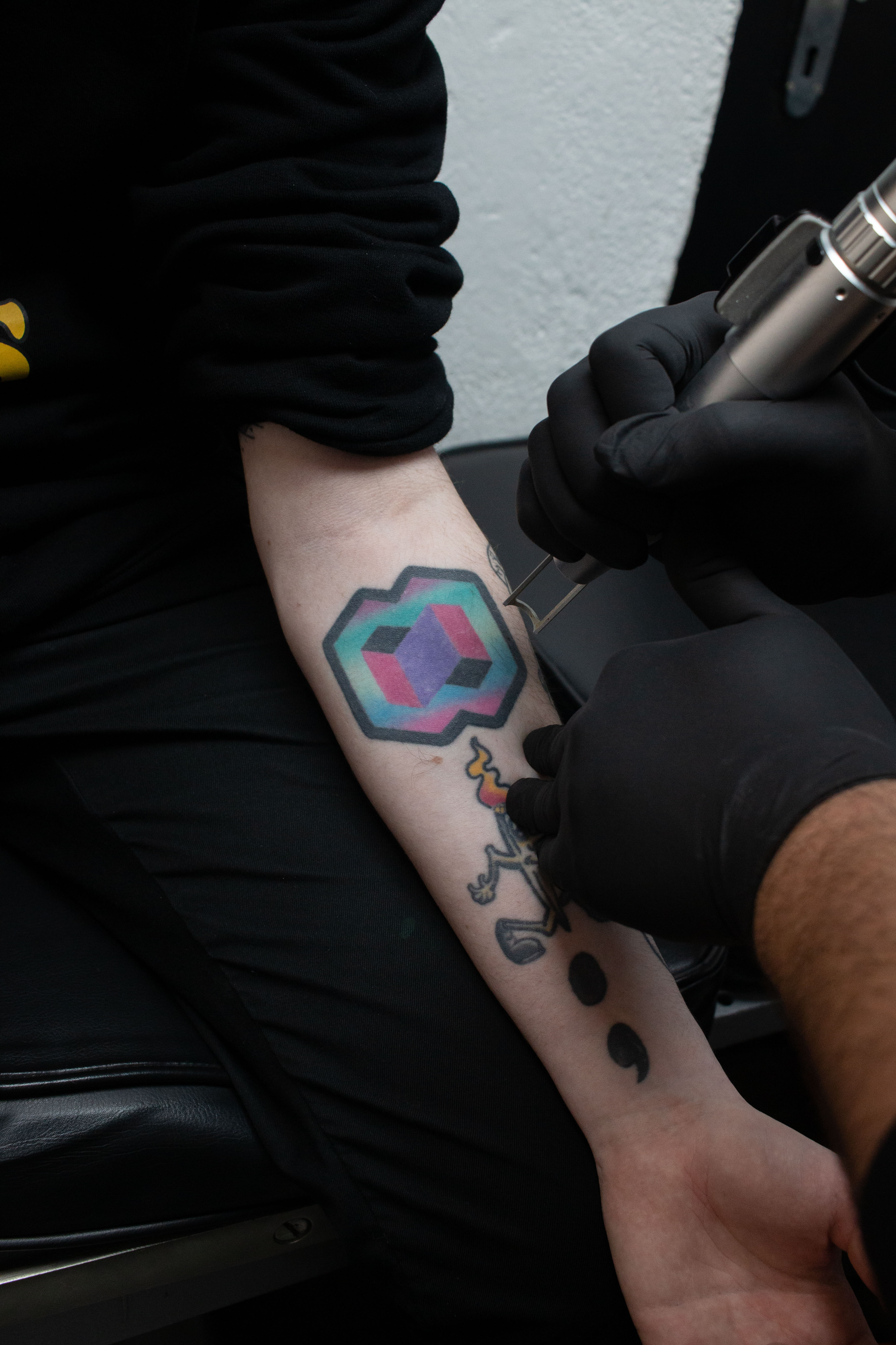 Best Laser tattoo removal in Dublin